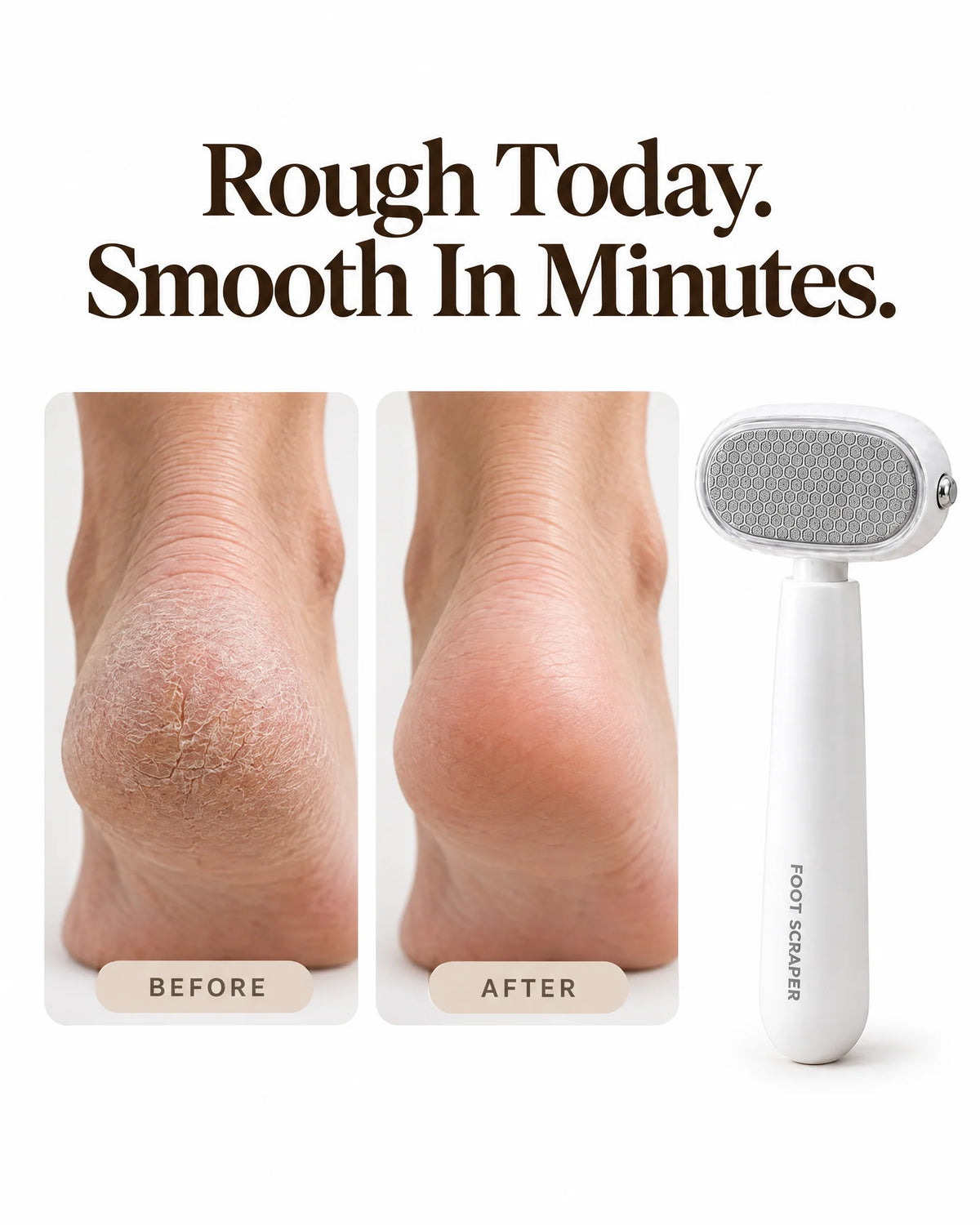 The Heel Silk - Guarded Callus Peeler At Home
