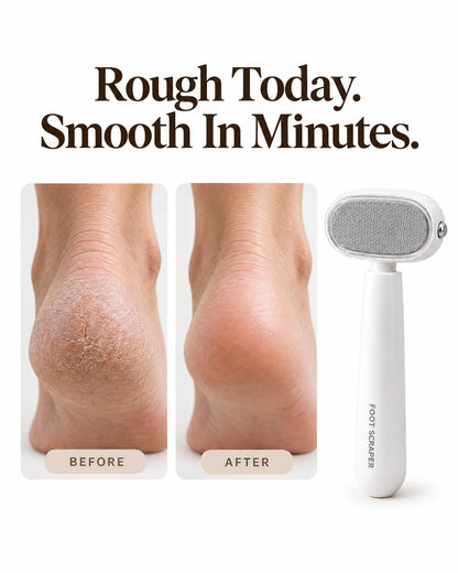 The Heel Silk - Guarded Callus Peeler At Home